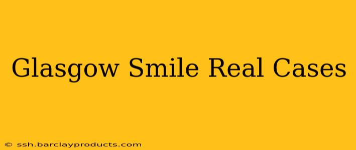 Glasgow Smile Real Cases